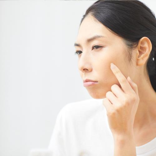 肌を気にする女性