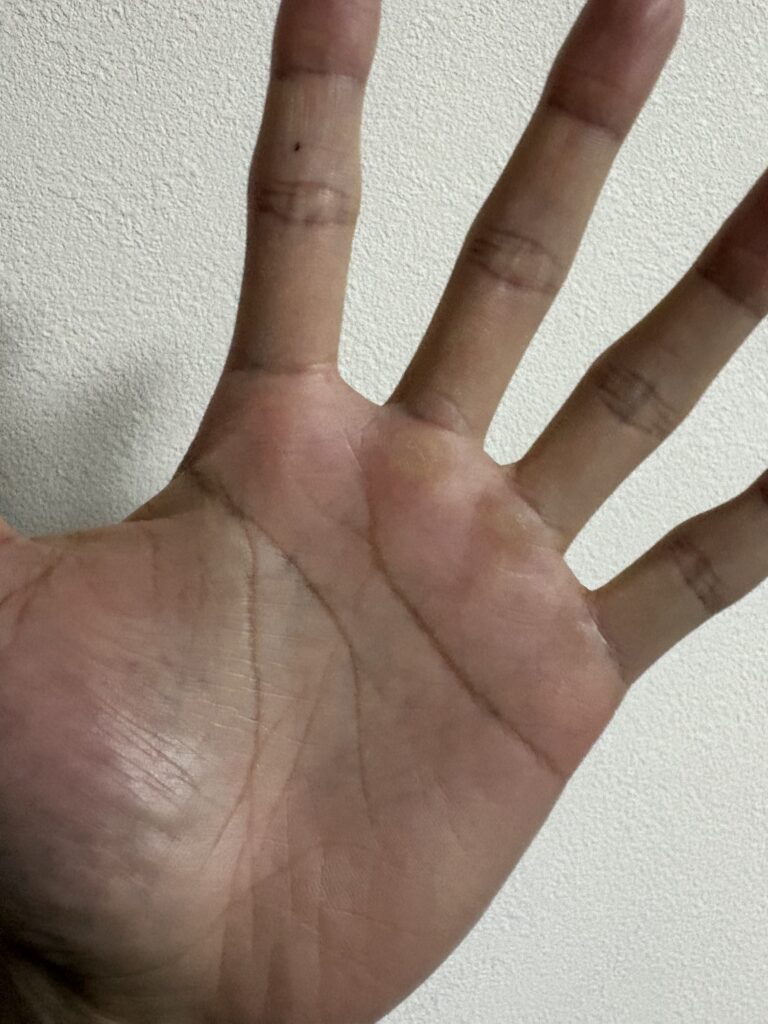 手のひら